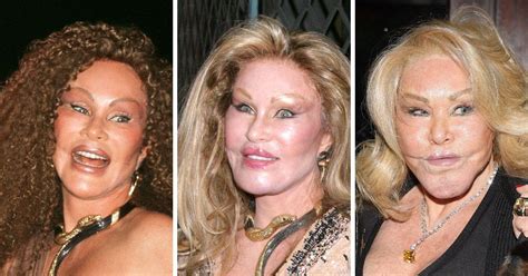 jocelyn wildenstein before surgery photos.